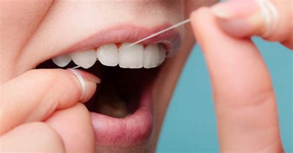 خيط تنظيف الأسنان هو قطعة رقيقة تشبه الخيوط تُستخدم لتنظيف الأسنان واللثة. من المهم استخدام الخيط يوميًا لأنه يزيل البلاك والبكتيريا من المناطق التي يصعب الوصول إليها بفرشاة الأسنان. هذا يساعد على منع أمراض اللثة وتسوس الأسنان.