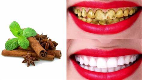 - الكركم: وقد ثبت أن هذه التوابل الصفراء فعالة في إزالة البقع من الأسنان.
